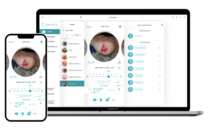 Dermatoo | Transformer la gestion opérationnelle des plaies chroniques